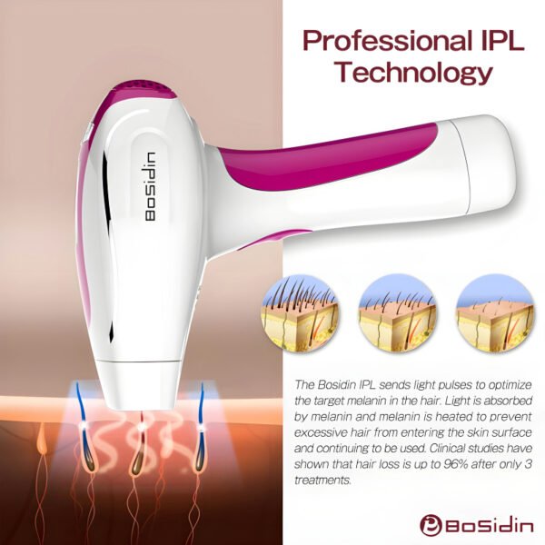 Bosidin D1011 IPL Laser Hair Removal Kit - Image 8