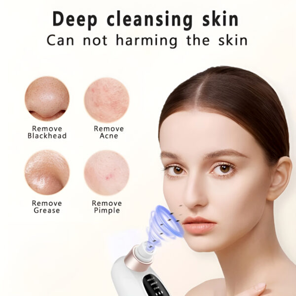 Rechargeable Bubble Blackhead Remover with Interchangeable Heads