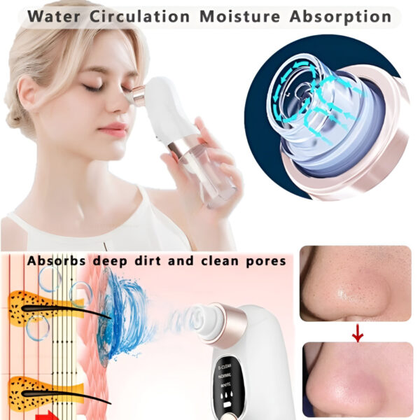 Rechargeable Bubble Blackhead Remover with Interchangeable Heads - Image 2