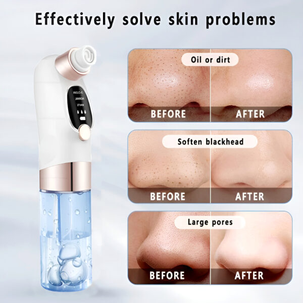 Rechargeable Bubble Blackhead Remover with Interchangeable Heads - Image 9