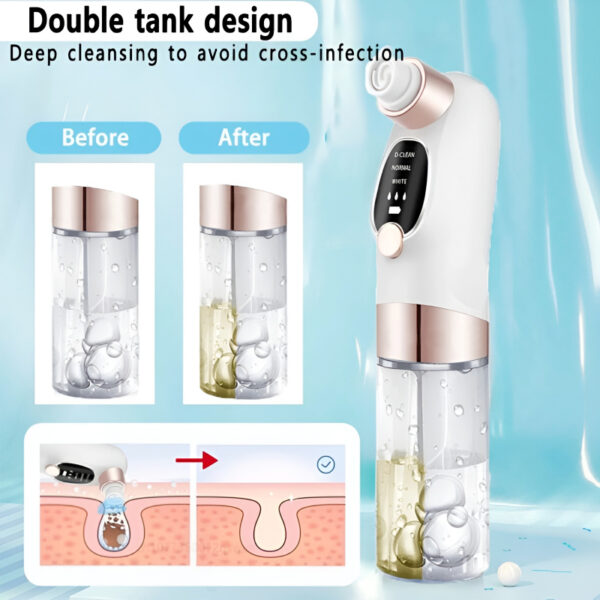 Rechargeable Bubble Blackhead Remover with Interchangeable Heads - Image 7